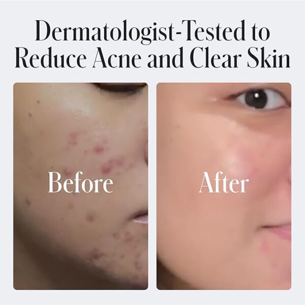 Geologie 2% Salicylic Acid Unscented Face Wash - Image 3