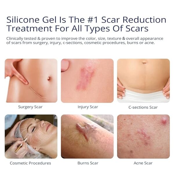 100% Silicone Scar Gel Scar Cream - Advanced Scar Gel for Surgical Scars - Image 2