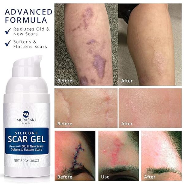 100% Silicone Scar Gel Scar Cream - Advanced Scar Gel for Surgical Scars - Image 3