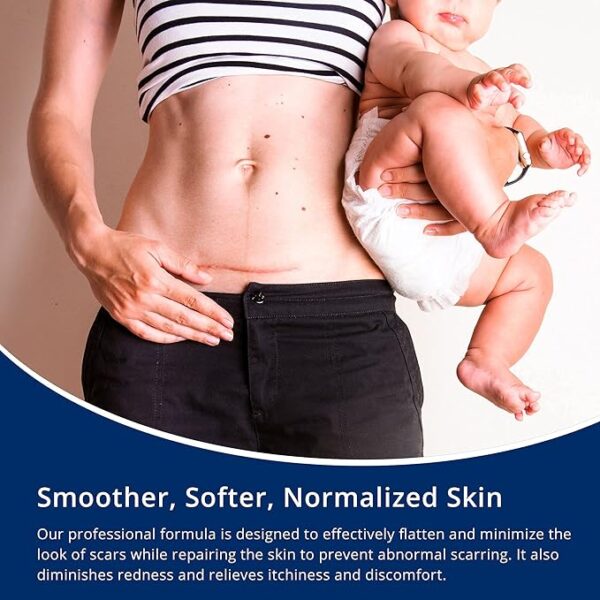 100% Silicone Scar Gel Scar Cream - Advanced Scar Gel for Surgical Scars - Image 5